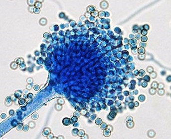 micotoxinas