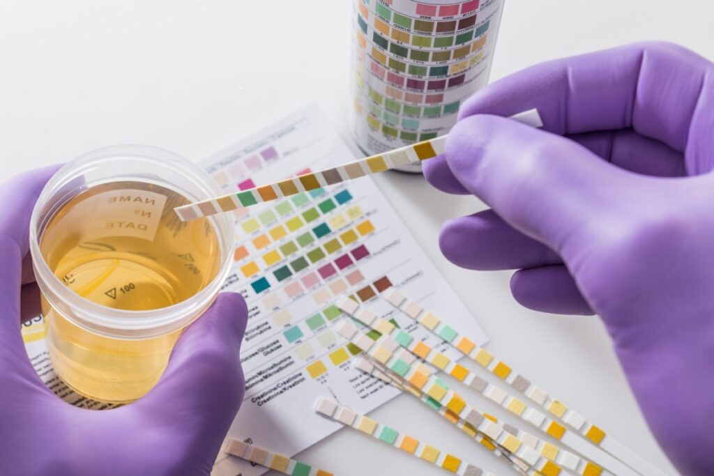 Metabolitos orgánicos y micotoxinas en orina: una ventana a su salud intestinal